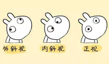 斜视.jpg